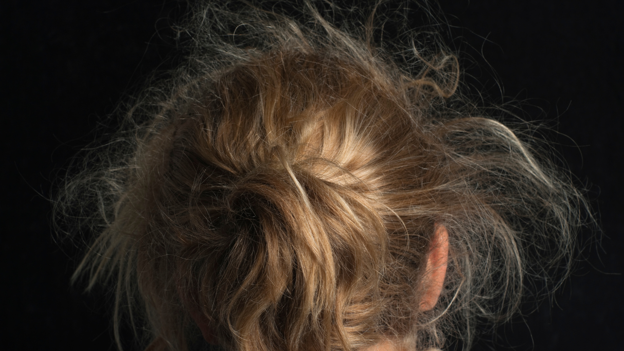 Why Does Hair Get Frizzy During Monsoon?