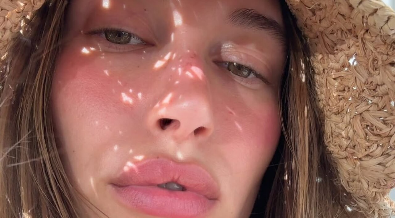 Sunburn Blush Trend