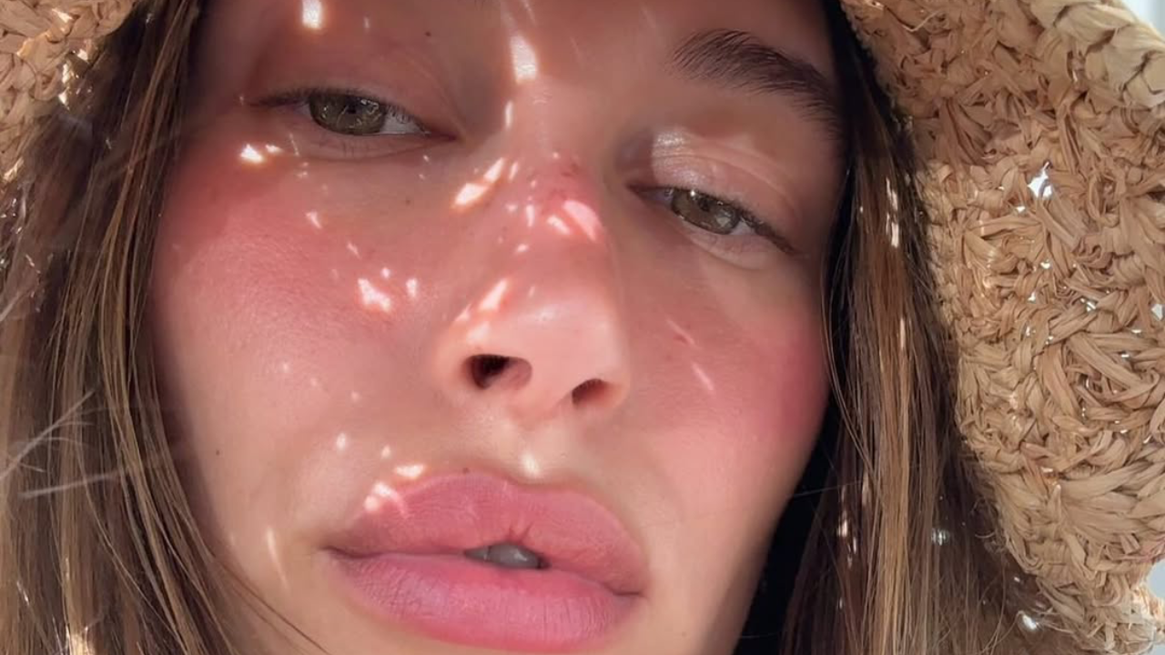 Sunburn Blush Trend