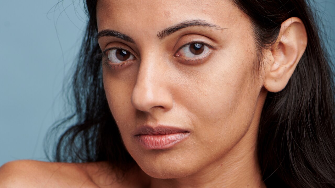 How Does Stress Affect Your Skin, as per Experts?