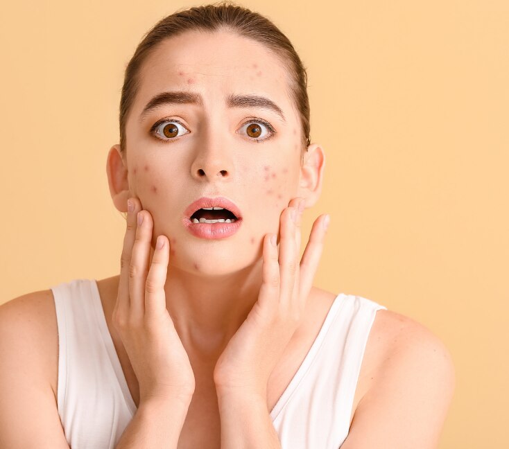 Image of Cortisol Face Explained: What Stress Does to Your Skin and How to Actually Fix It