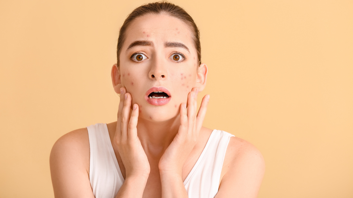 Cortisol Face Explained Stress and Skin Puffiness Effects