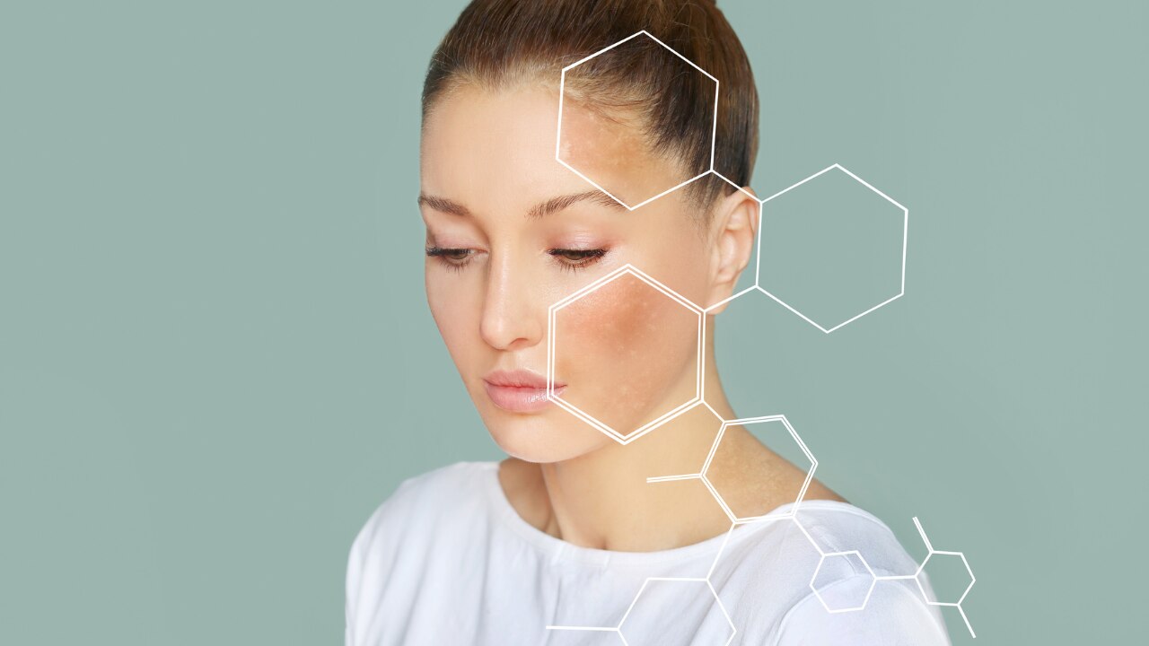 What Happens When Your Skin Barrier Is Damaged?