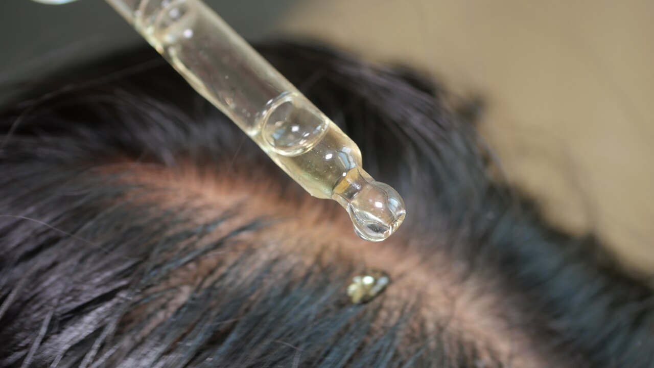 How Hair Growth Works