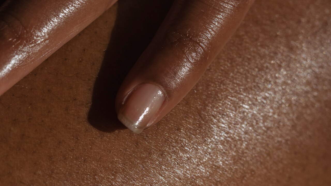 Dehydrated Skin