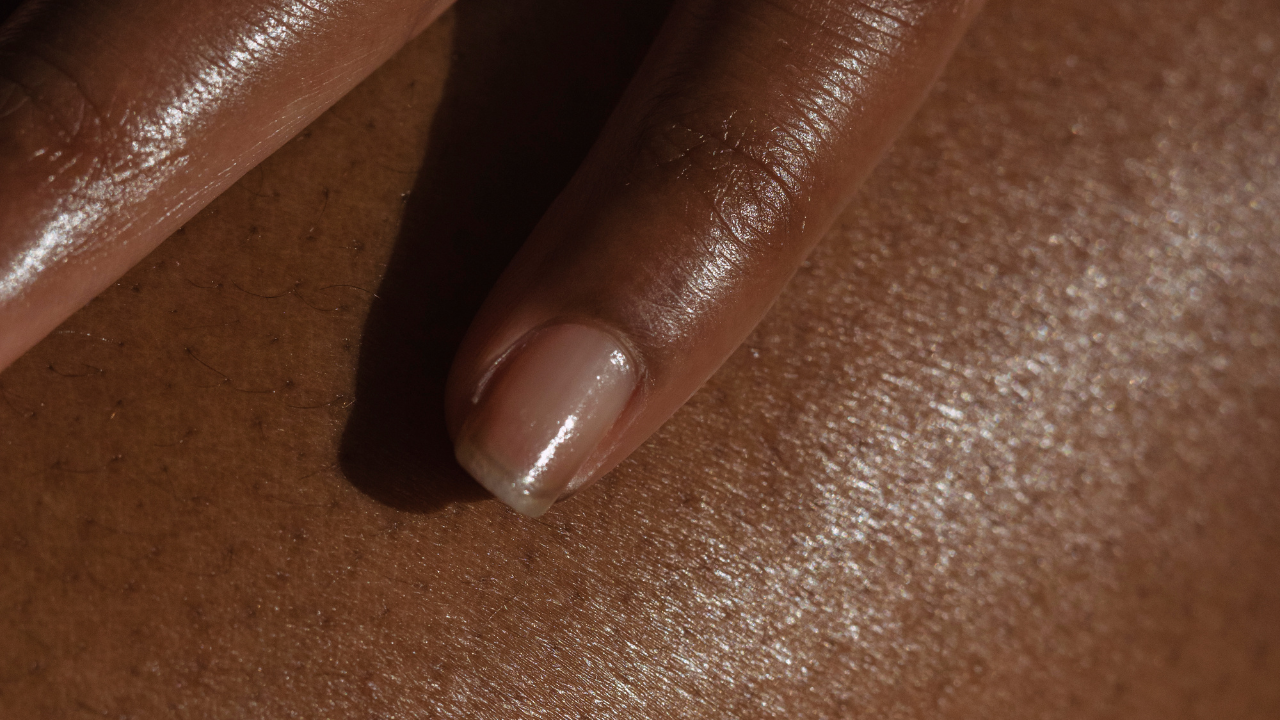 Dehydrated Skin