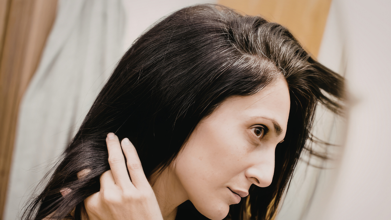 How to Manage Greasy Hair During Monsoon