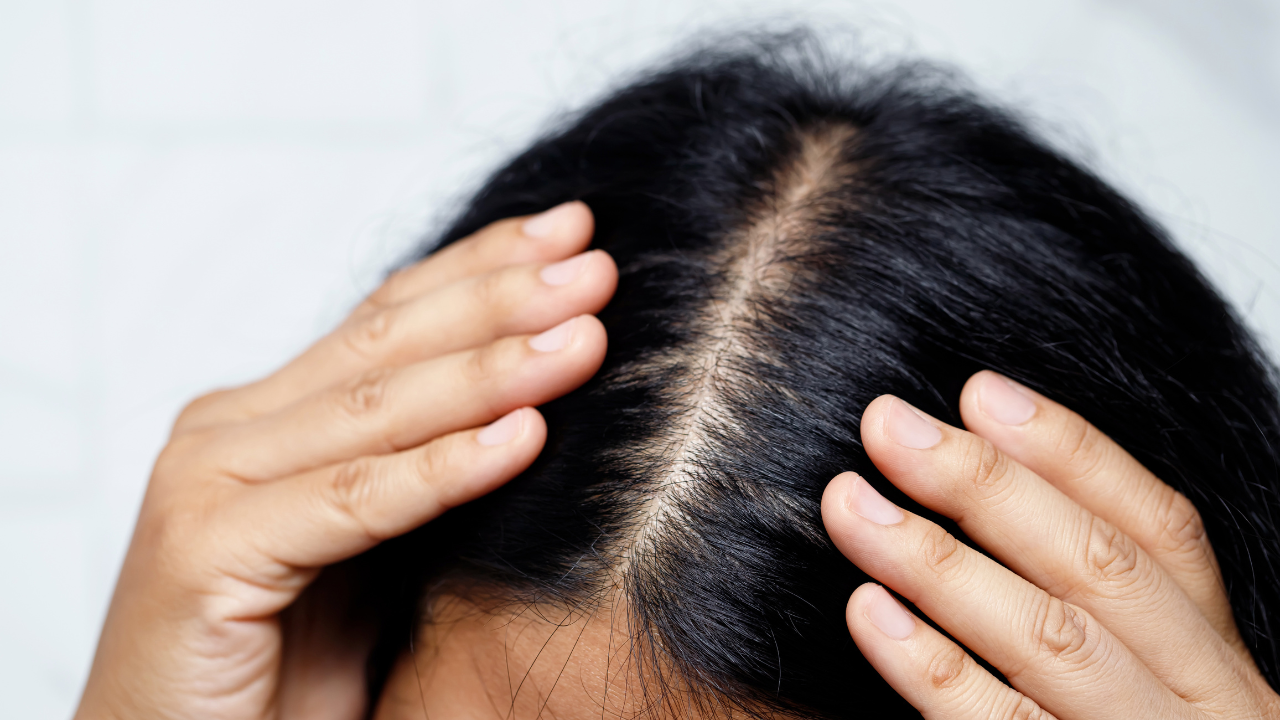 Signs Your Scalp Is Producing Excess Oil