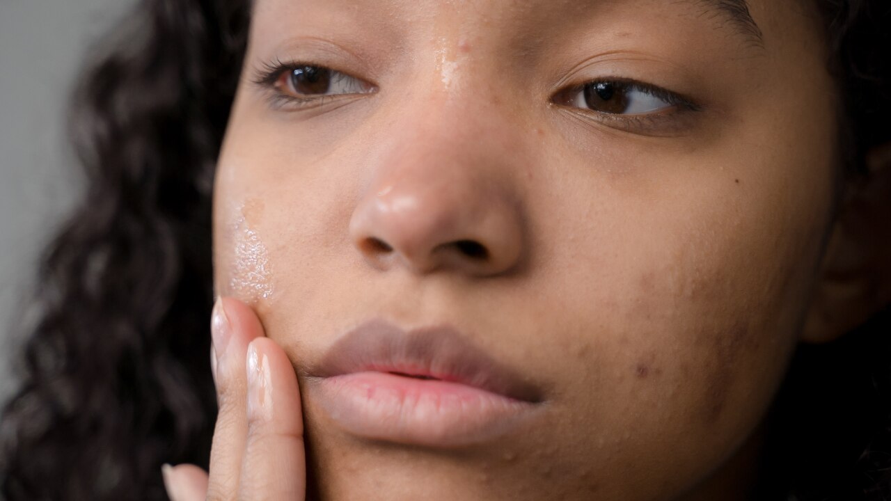 2. Hair & Skin Concerns