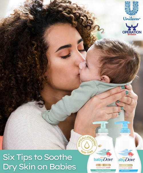 Baby Dove six tips to soothe dry skin on babies article