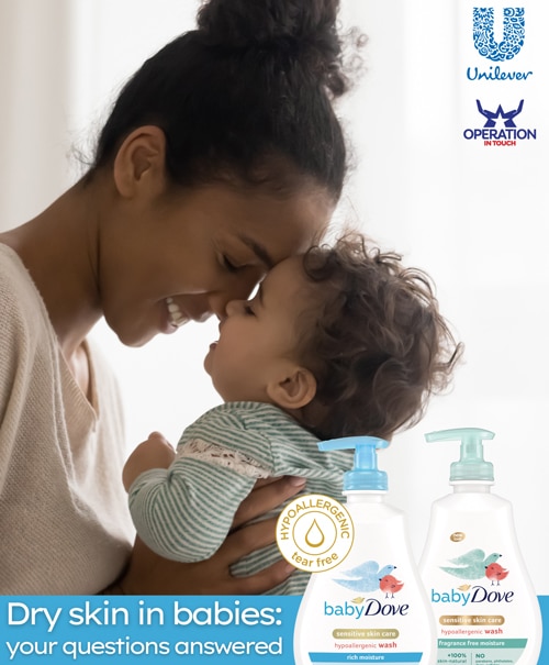Baby Dove dry skin in babies article