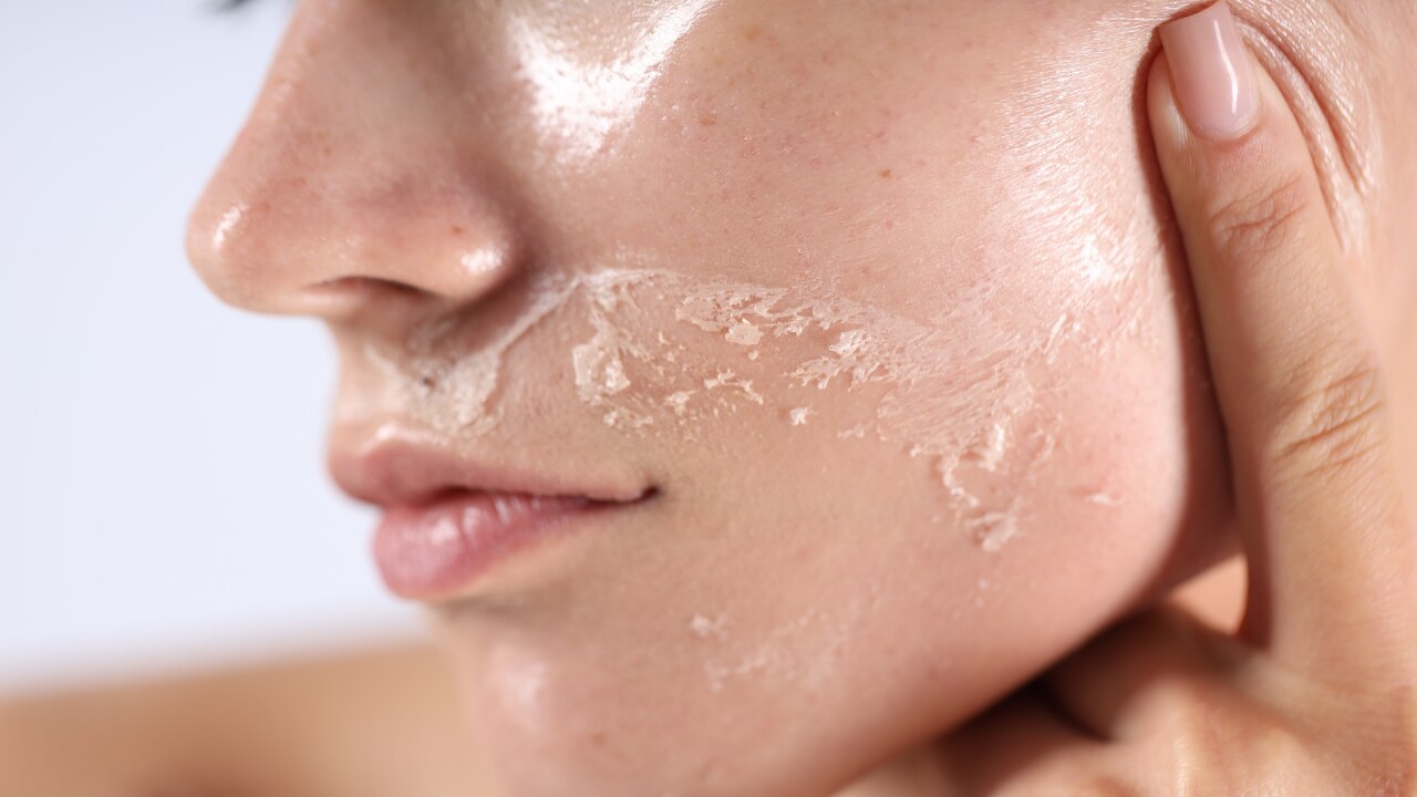 Common Monsoon Skin Problems