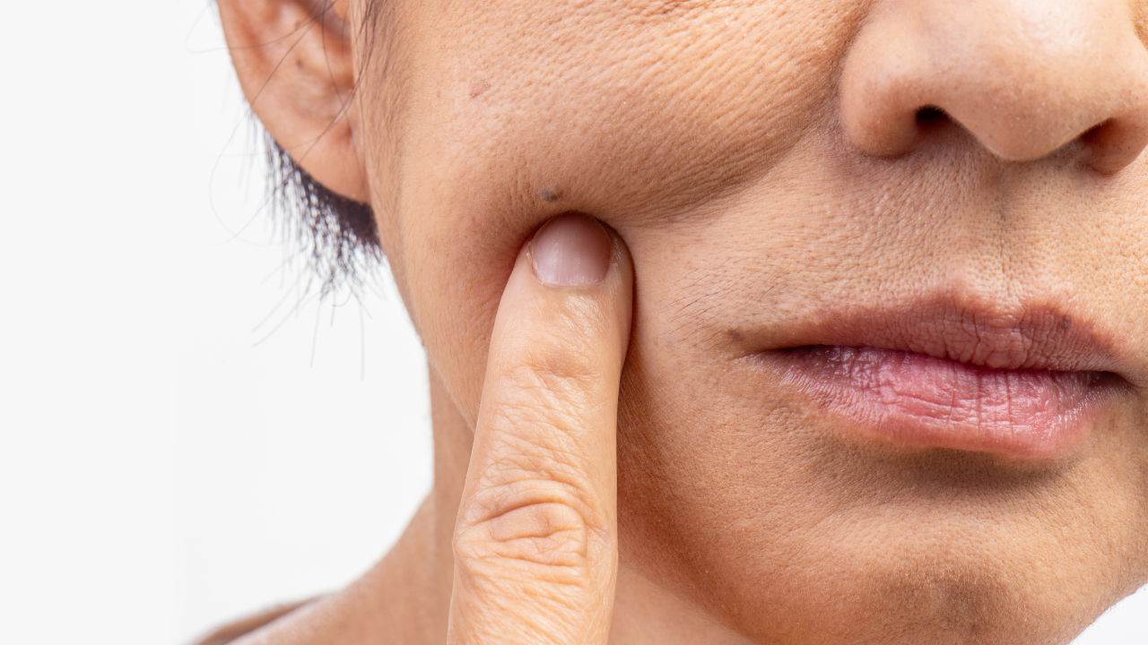 Signs Your Skin Barrier Might Be Damaged