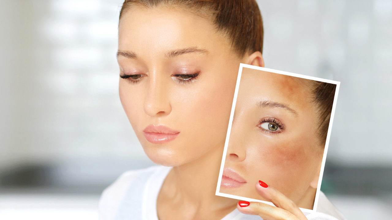 How Long Does It Take To See Results?