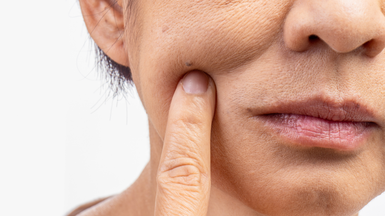 Who Should Use Collagen Face Masks?