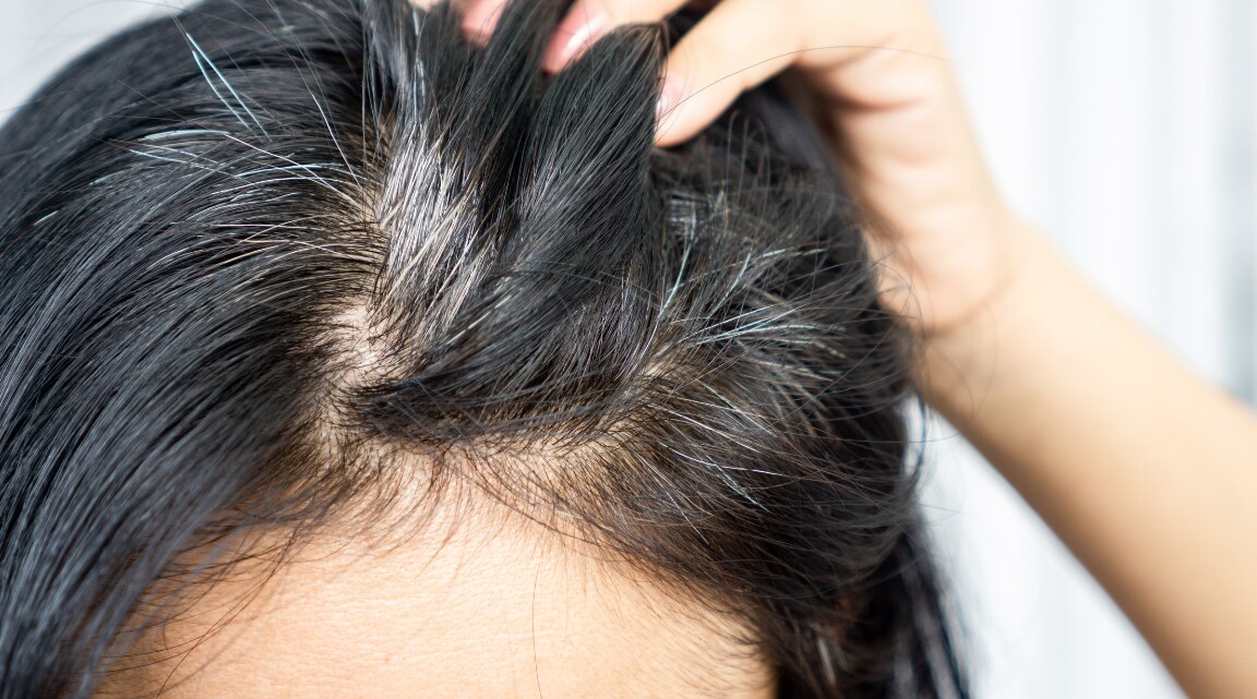 Premature Grey Hair Causes Prevention and Treatment Guide