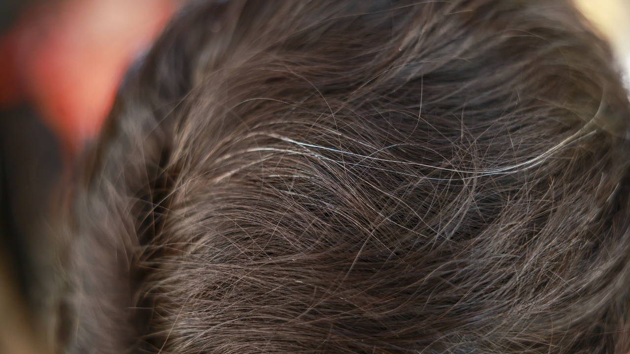 What Is Considered Premature Grey Hair?