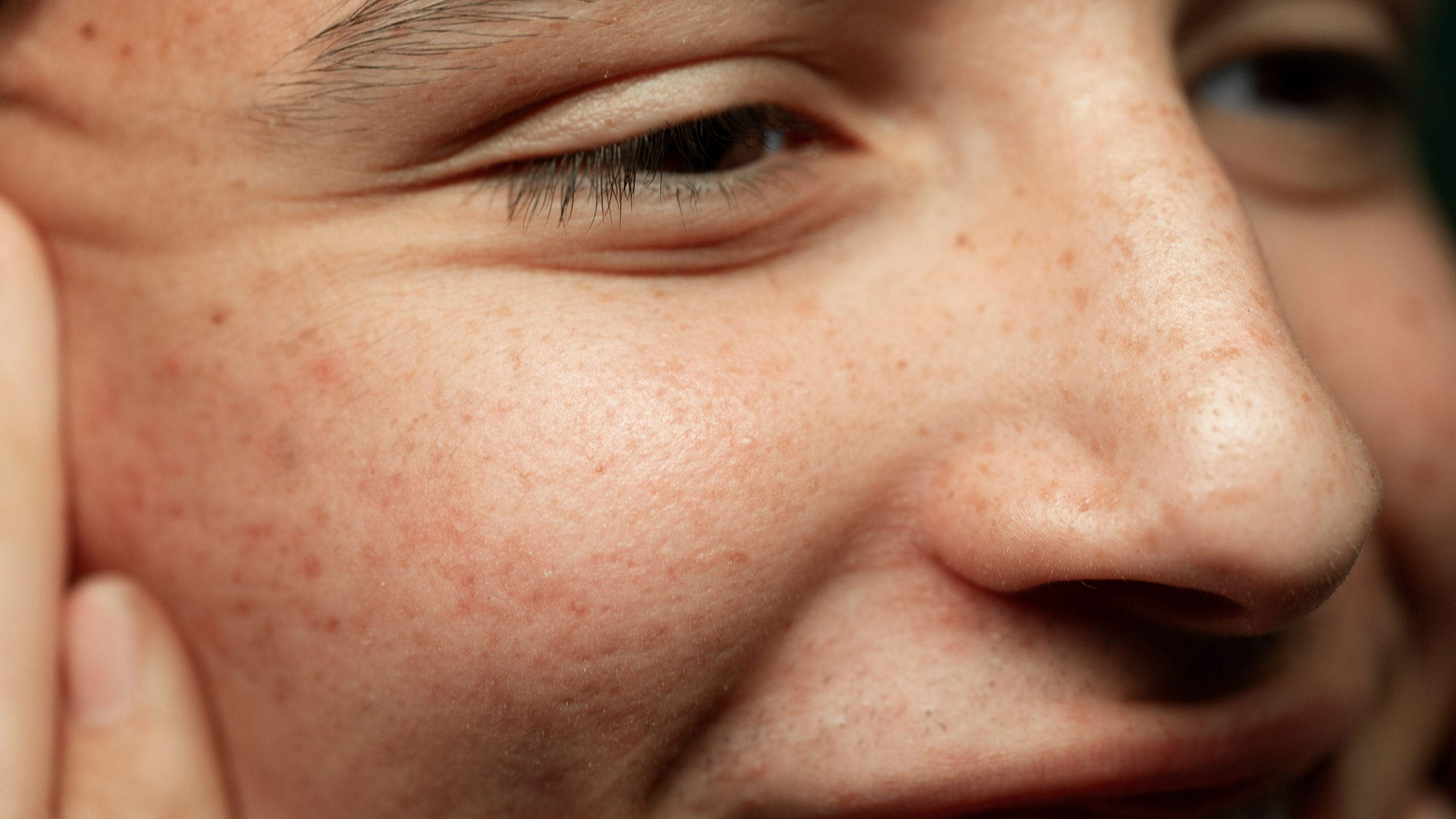 Preventative Lifestyle Habits for a Youthful Glow