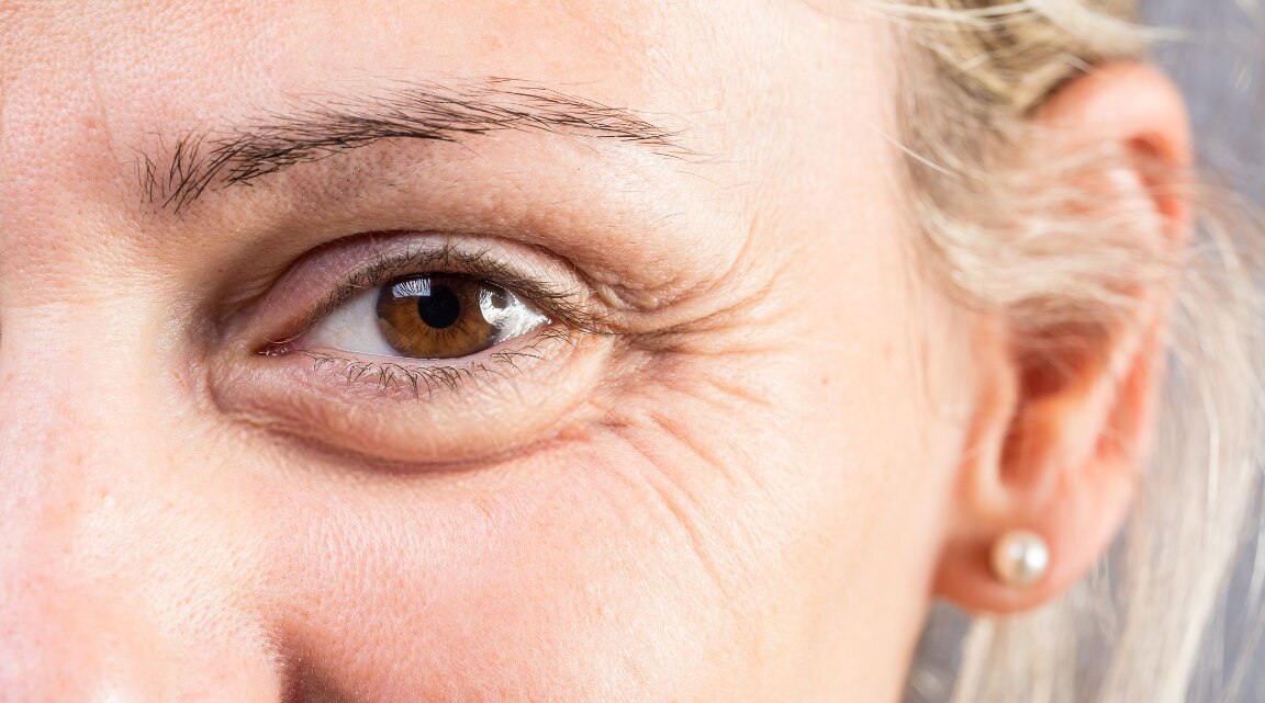 Fine Lines on Face Causes Prevention and Skincare Guide