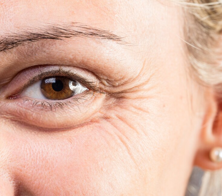 Image of Fine Lines on Face or Just Dry Skin? The Glow-Up Guide to Plumping Your Skin