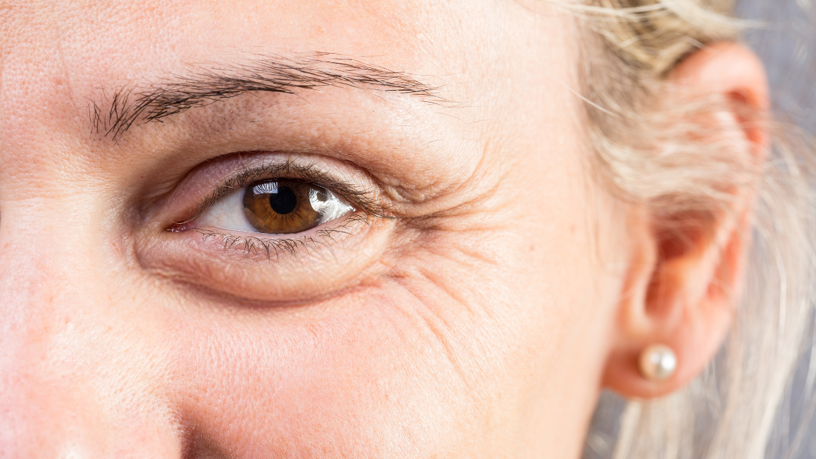 Fine Lines on Face Causes Prevention and Skincare Guide