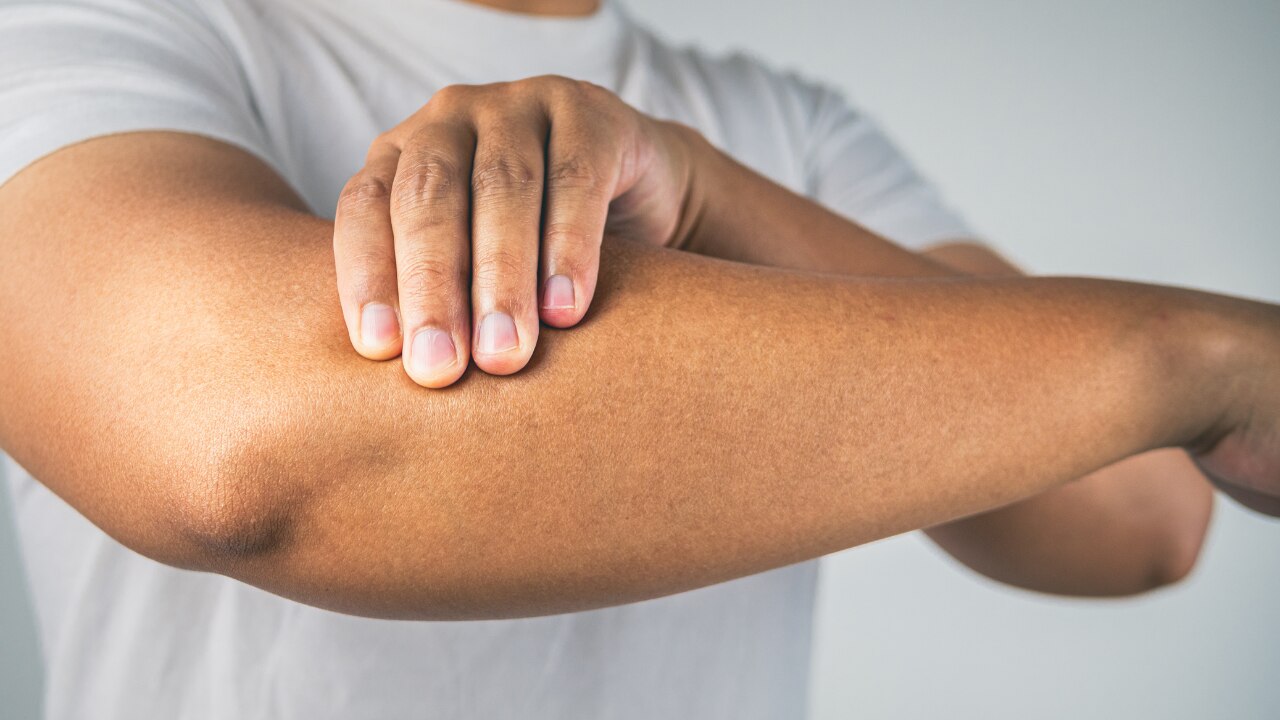 Dead Skin Cell Build-up