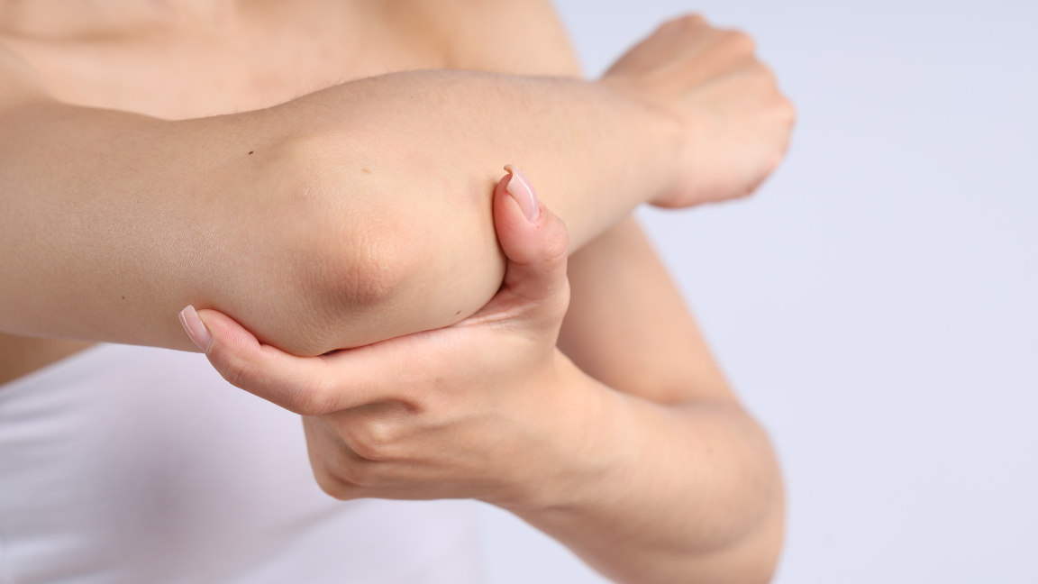How to Get Rid of Dark Elbows and Knees Naturally