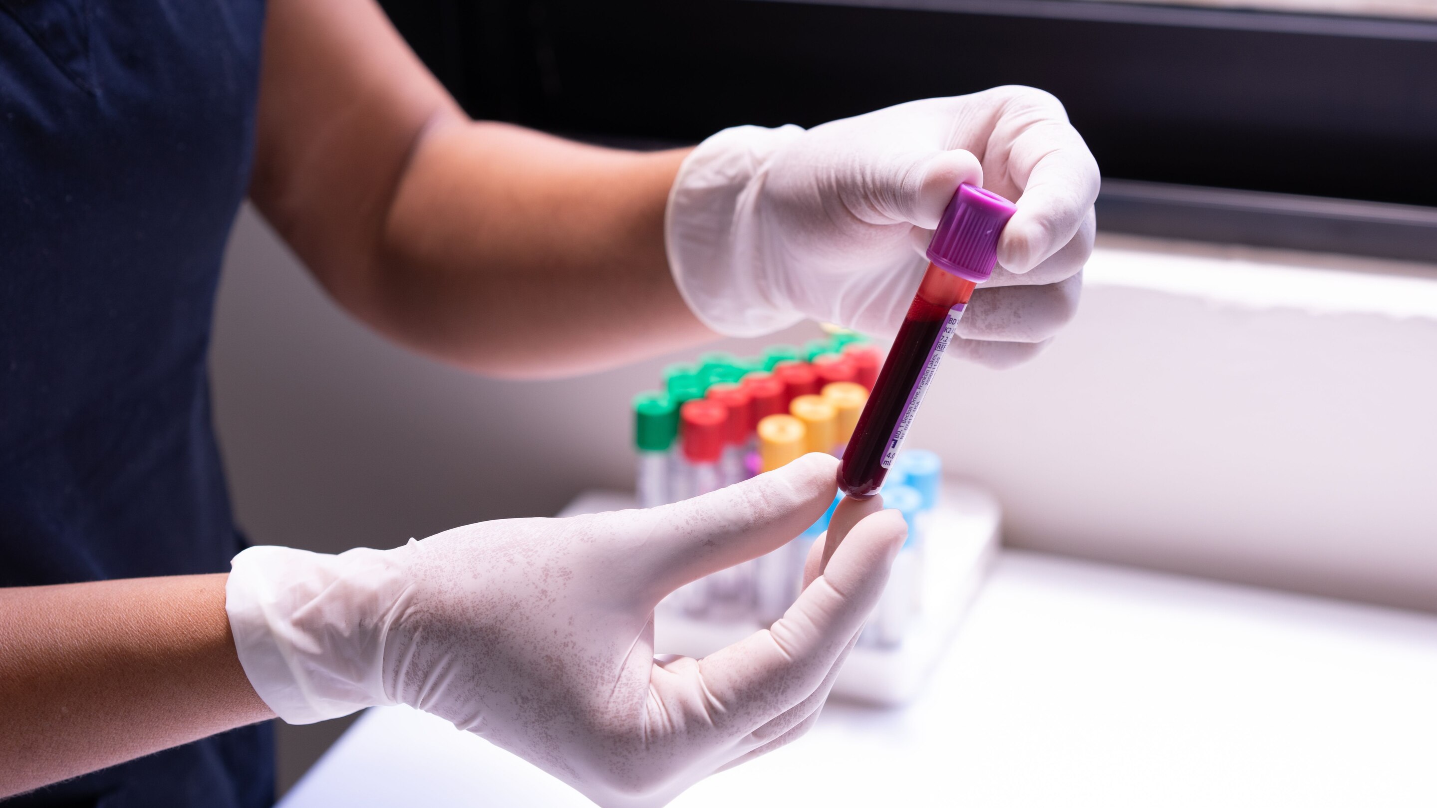 Blood Tests