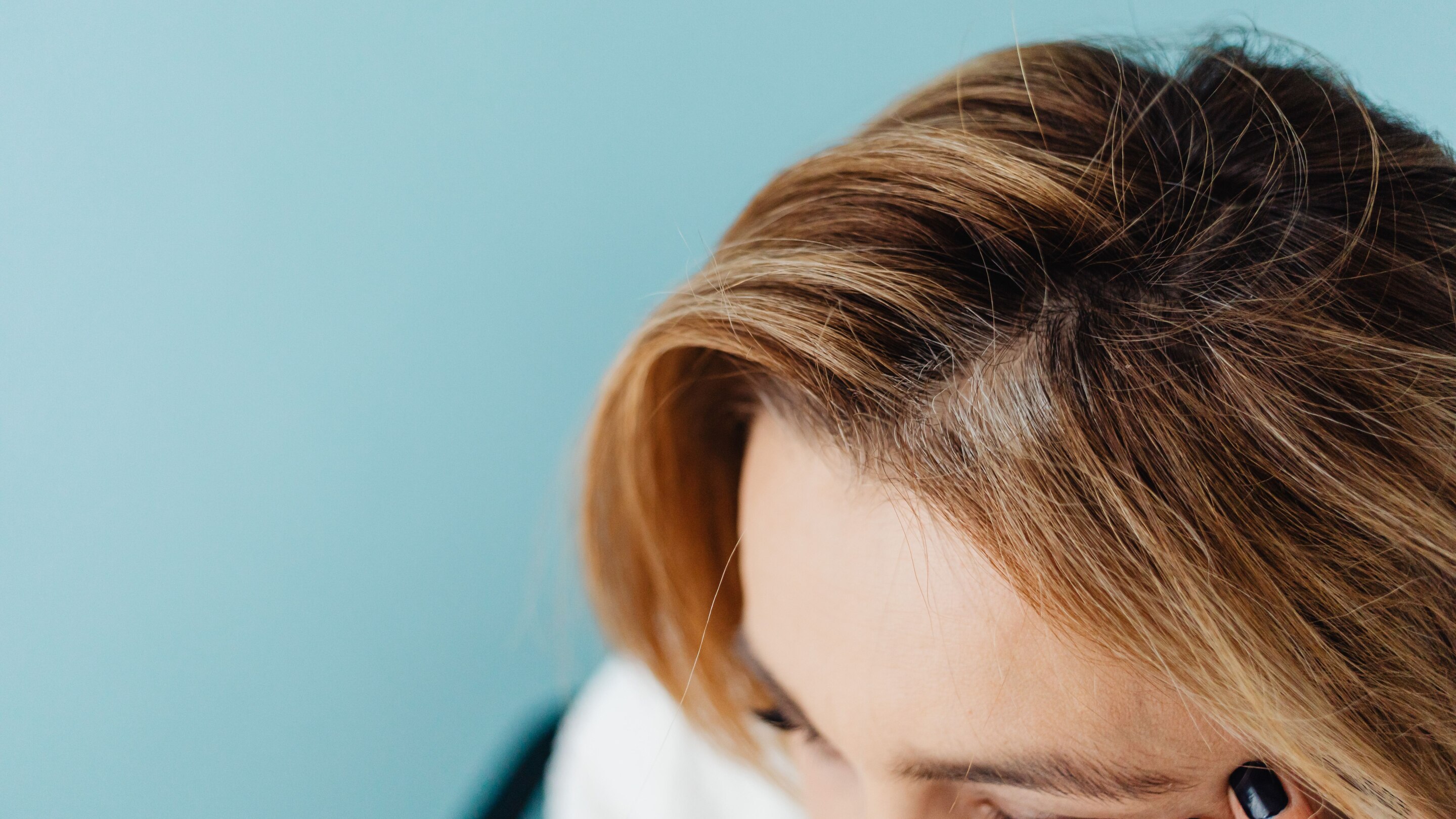 Patchy Hair Loss