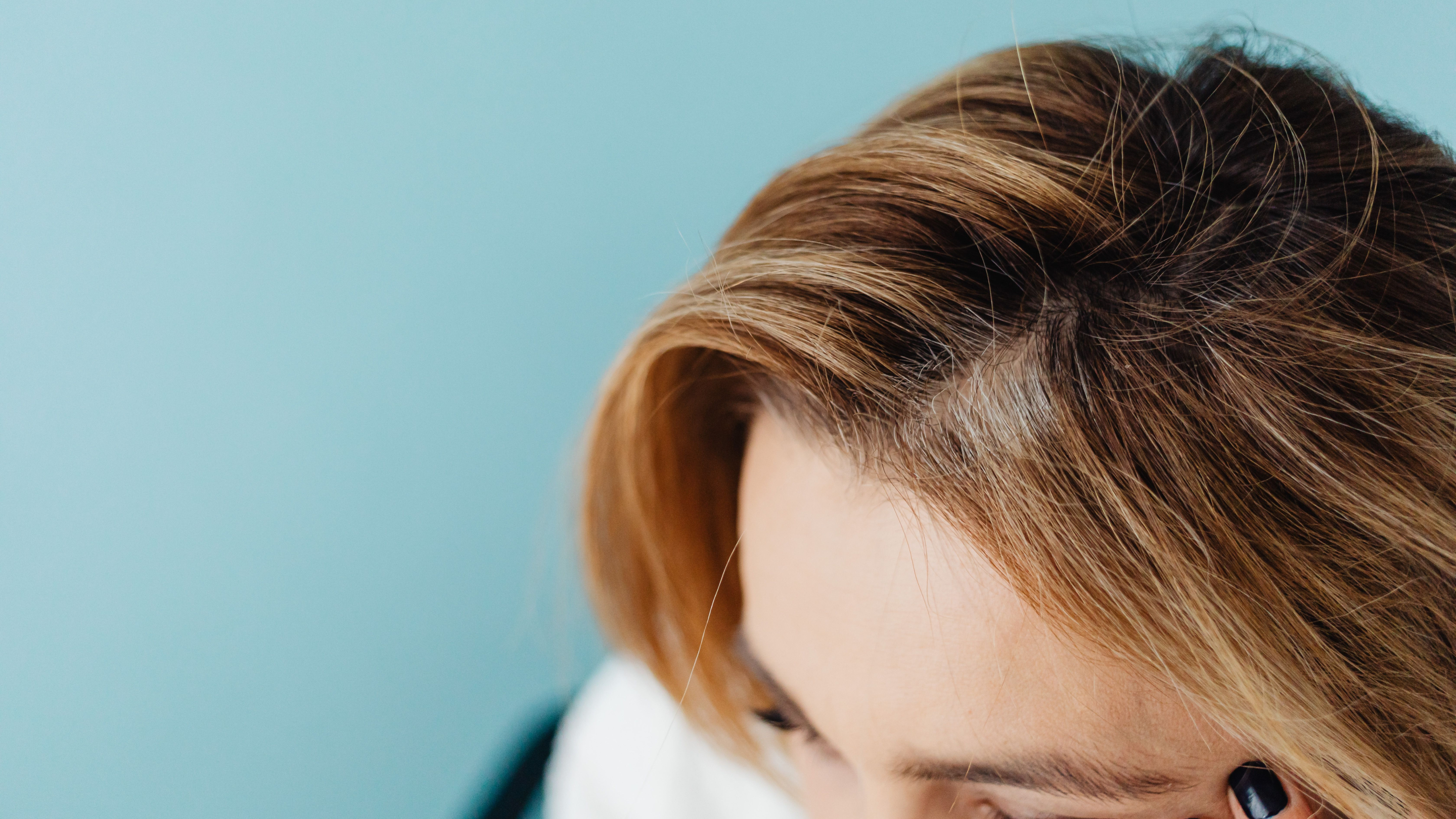 Patchy Hair Loss