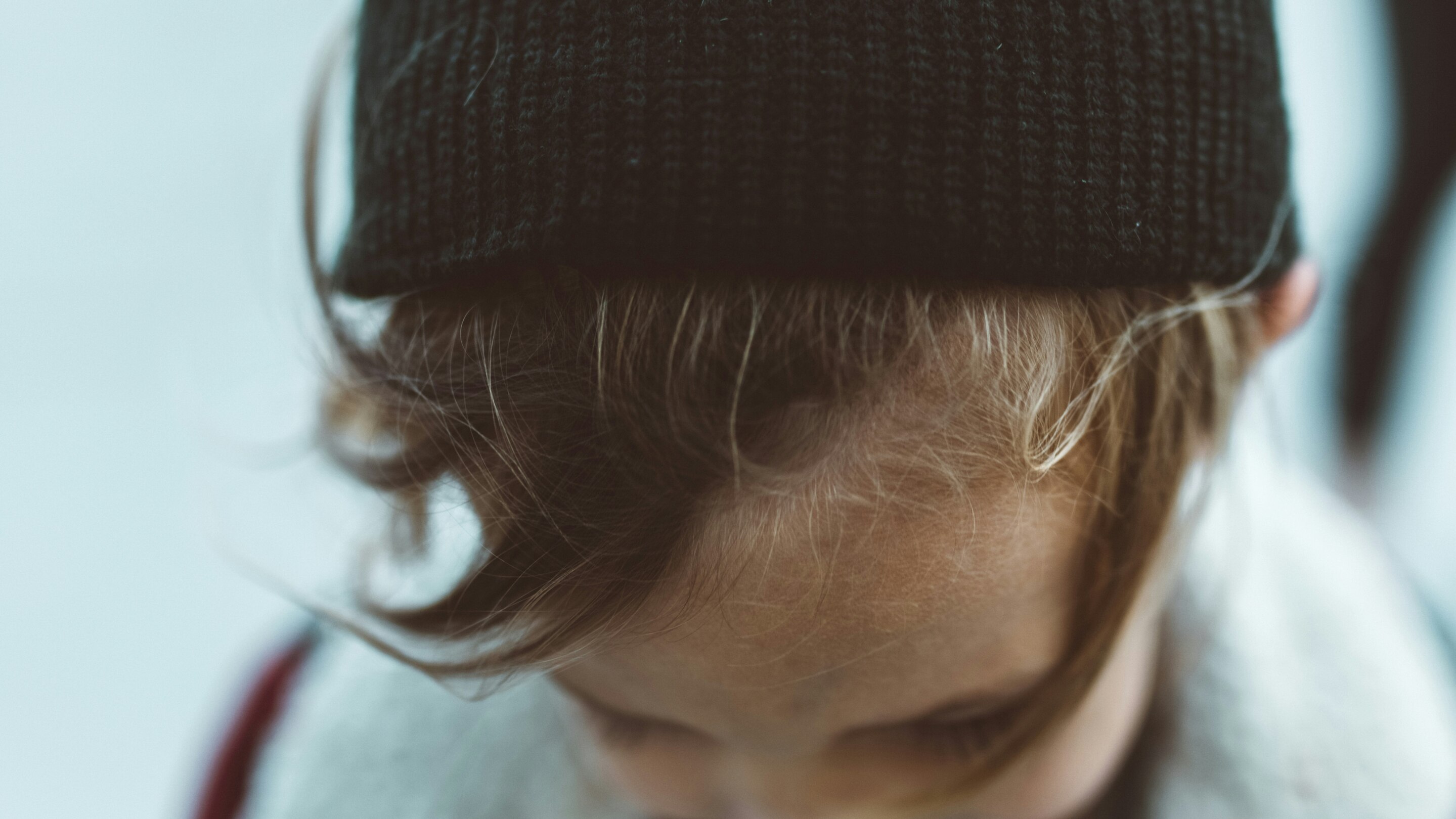 Hair Loss Affecting Confidence or Daily Life
