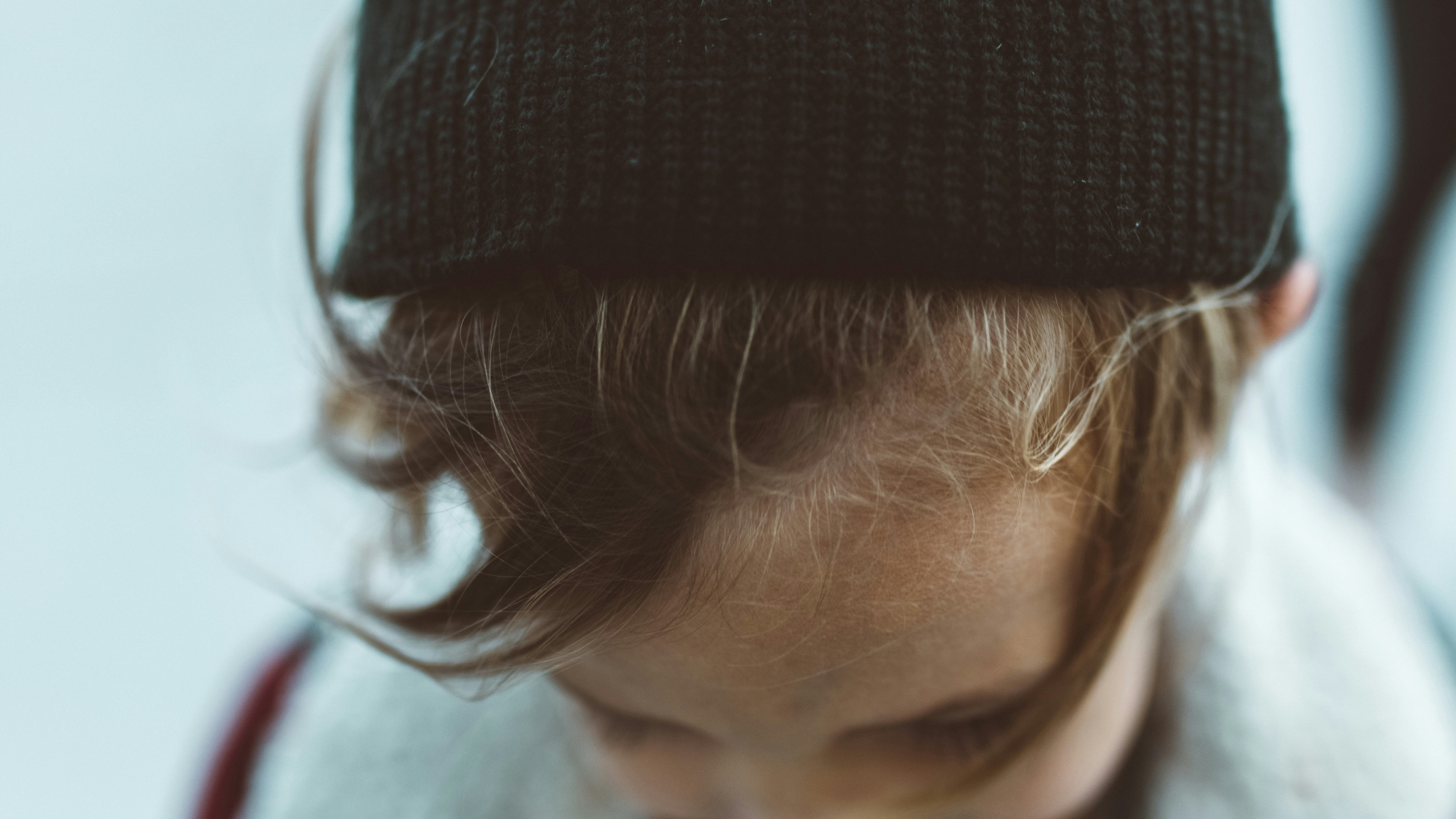 Hair Loss Affecting Confidence or Daily Life