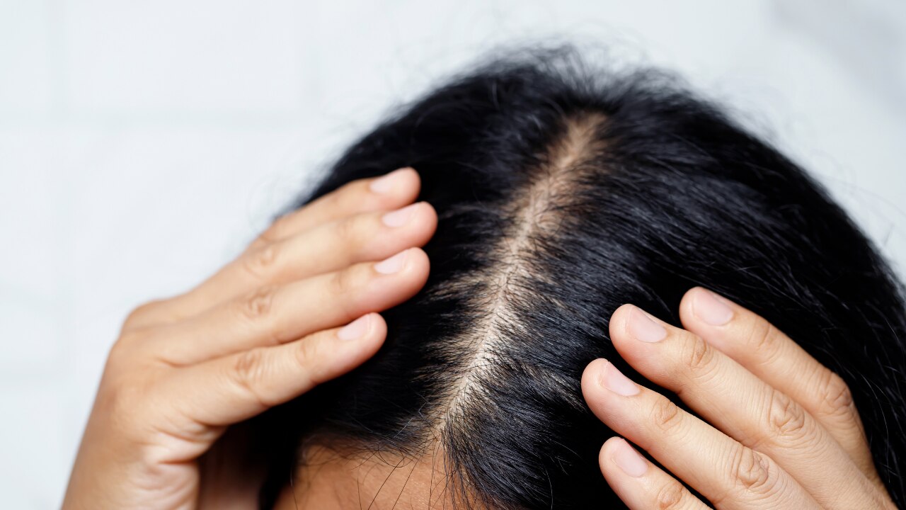 Step 2: Section Your Hair