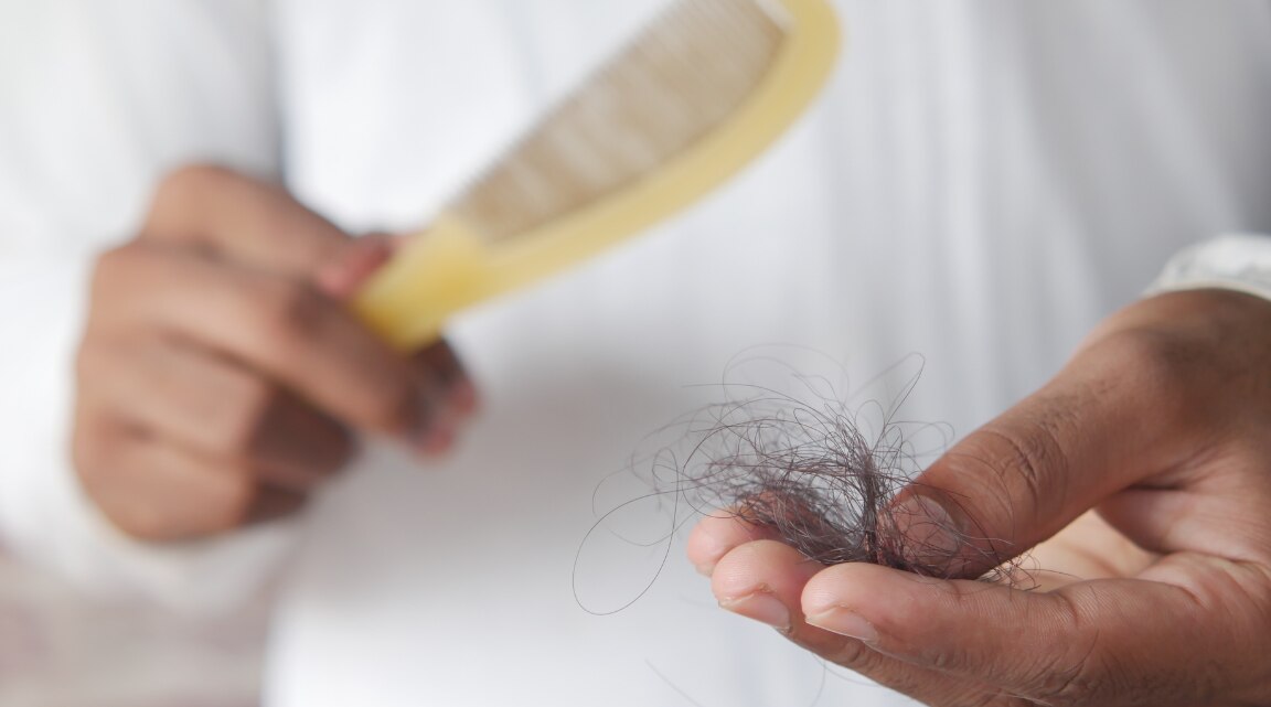 How Much Hair Fall Is Normal and When to See a Doctor