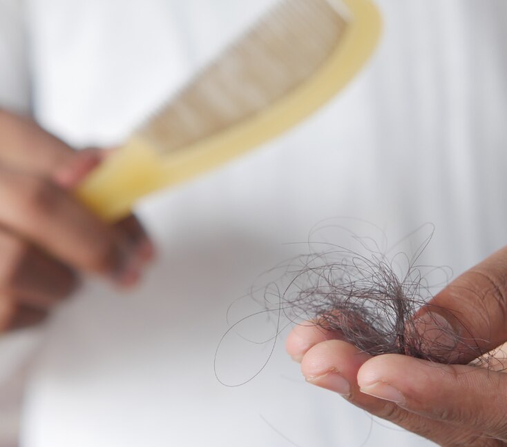 Image of How Much Hair Fall Is Normal? Here's When You Should See a Doctor