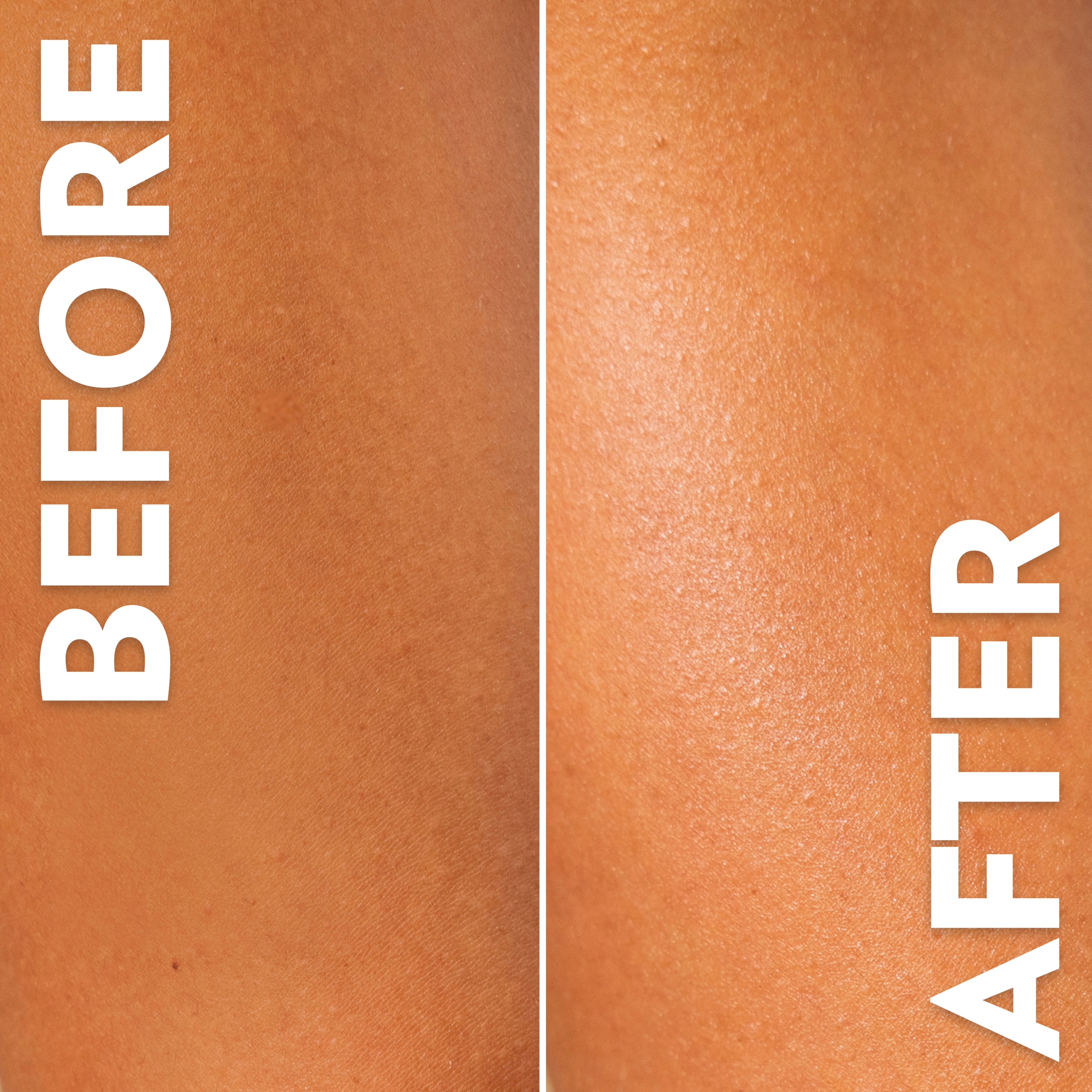Side-by-side close-up comparison of skin labeled “Before” and “After,” showing a smoother, more radiant appearance after moisturizing.