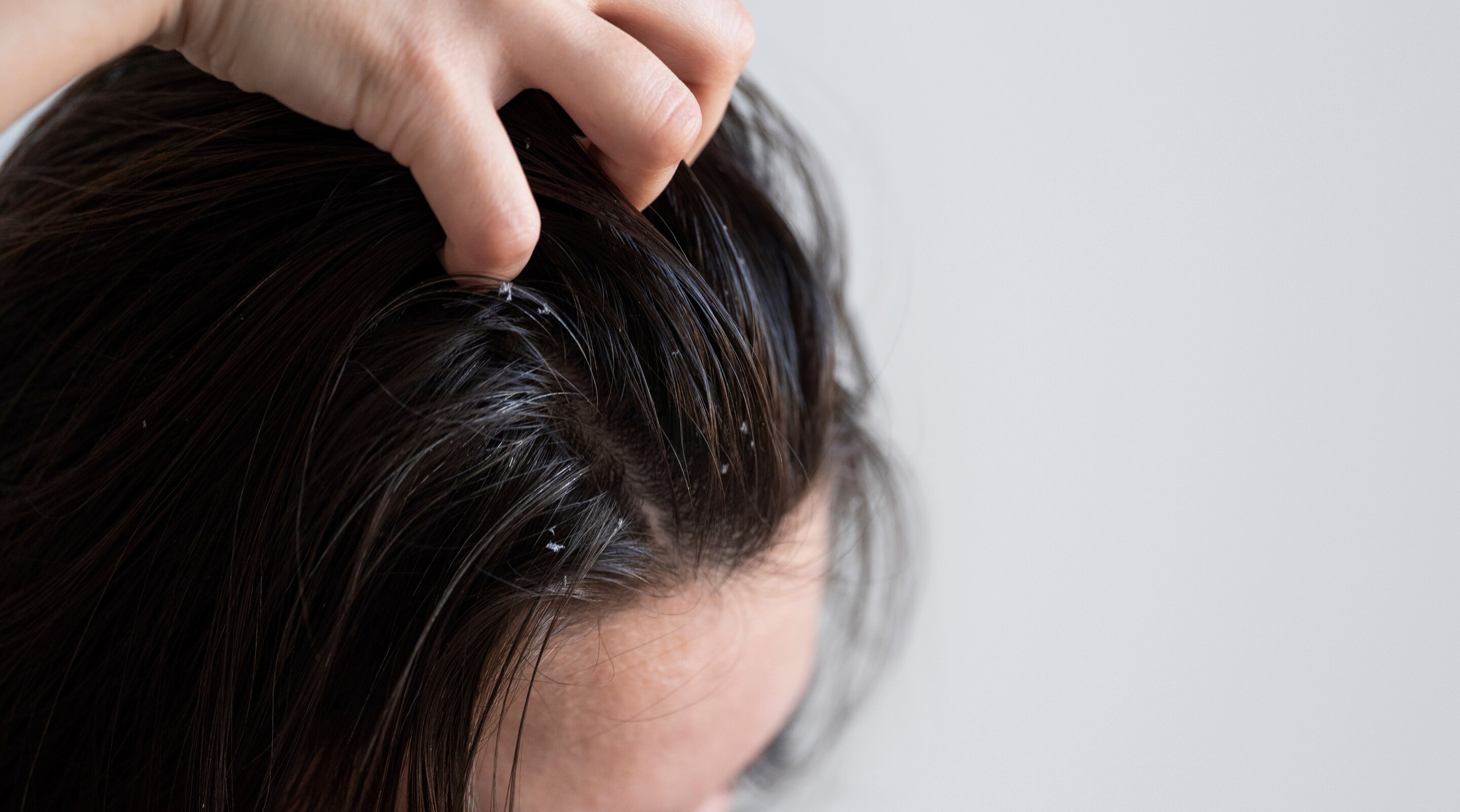 Shampoo for Oily Scalp with Ingredients to Look For