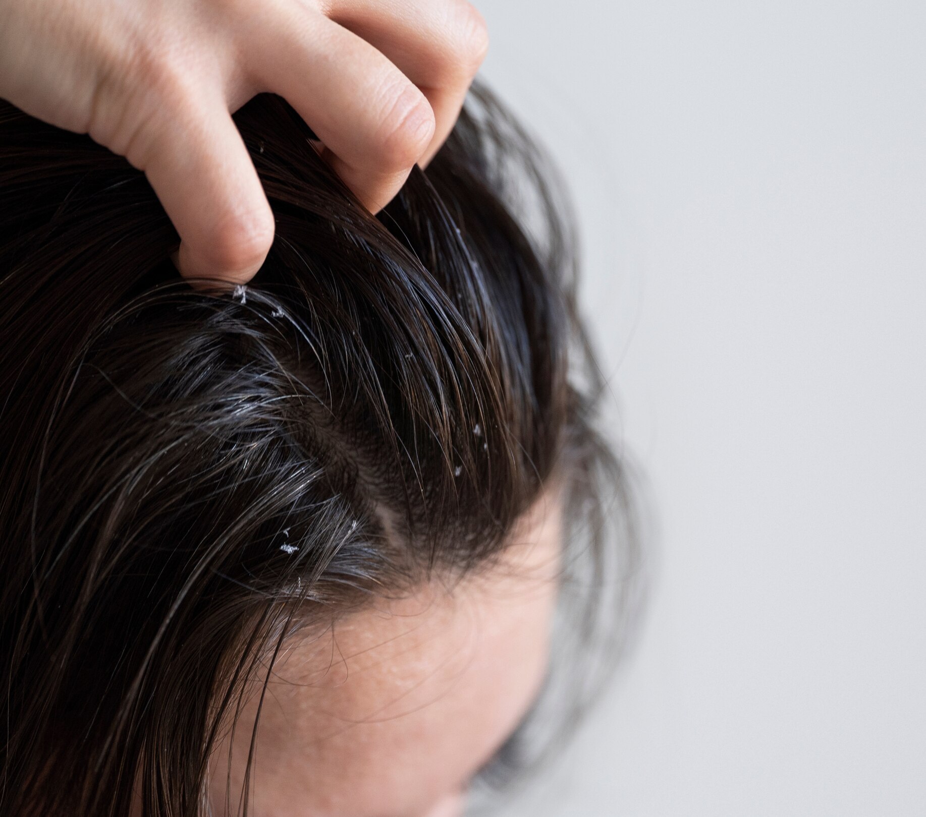 Image of Shampoo for Oily Scalp: Ingredients to Look For & Expert Picks