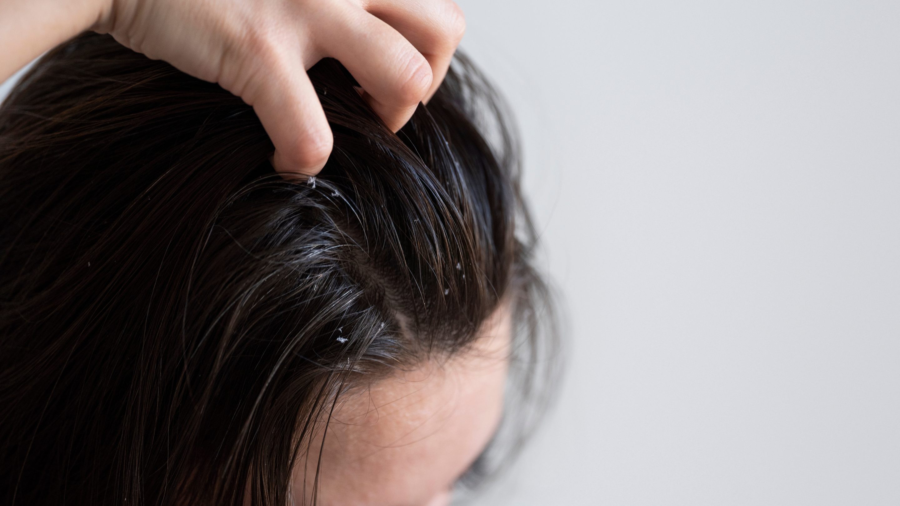 Shampoo for Oily Scalp with Ingredients to Look For