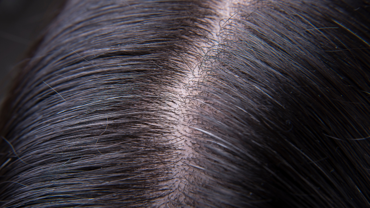 Identify Your Scalp Type