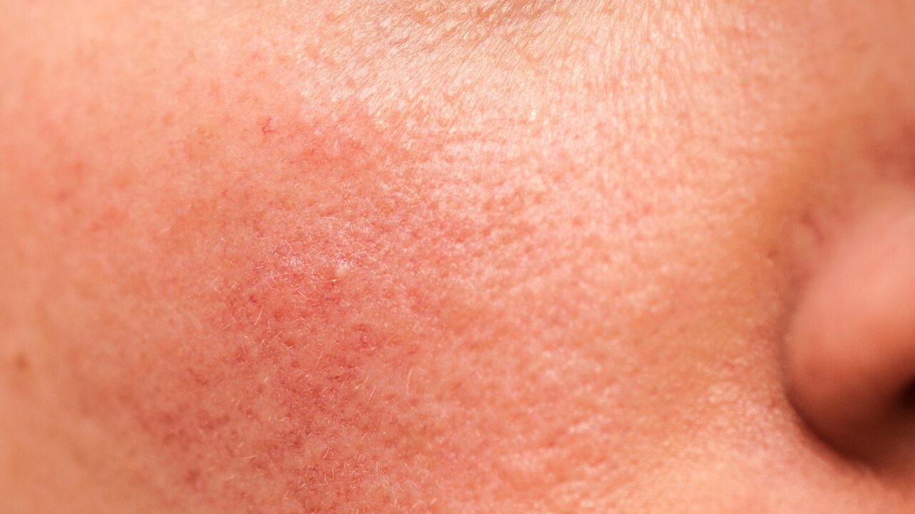 For Sensitive Skin