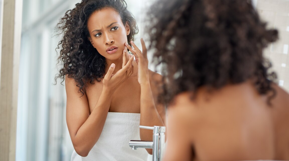 Best Acne Spot Treatments for Clearer-Looking Skin
