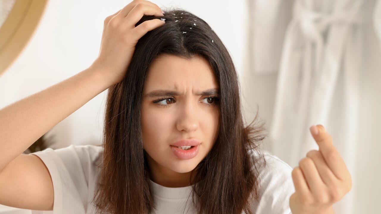 Oily Dandruff vs Dry Dandruff