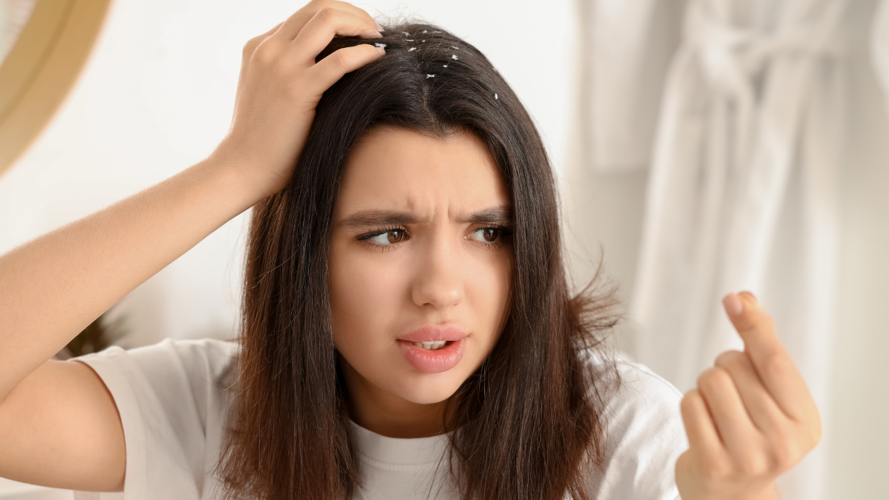 Oily Dandruff vs Dry Dandruff