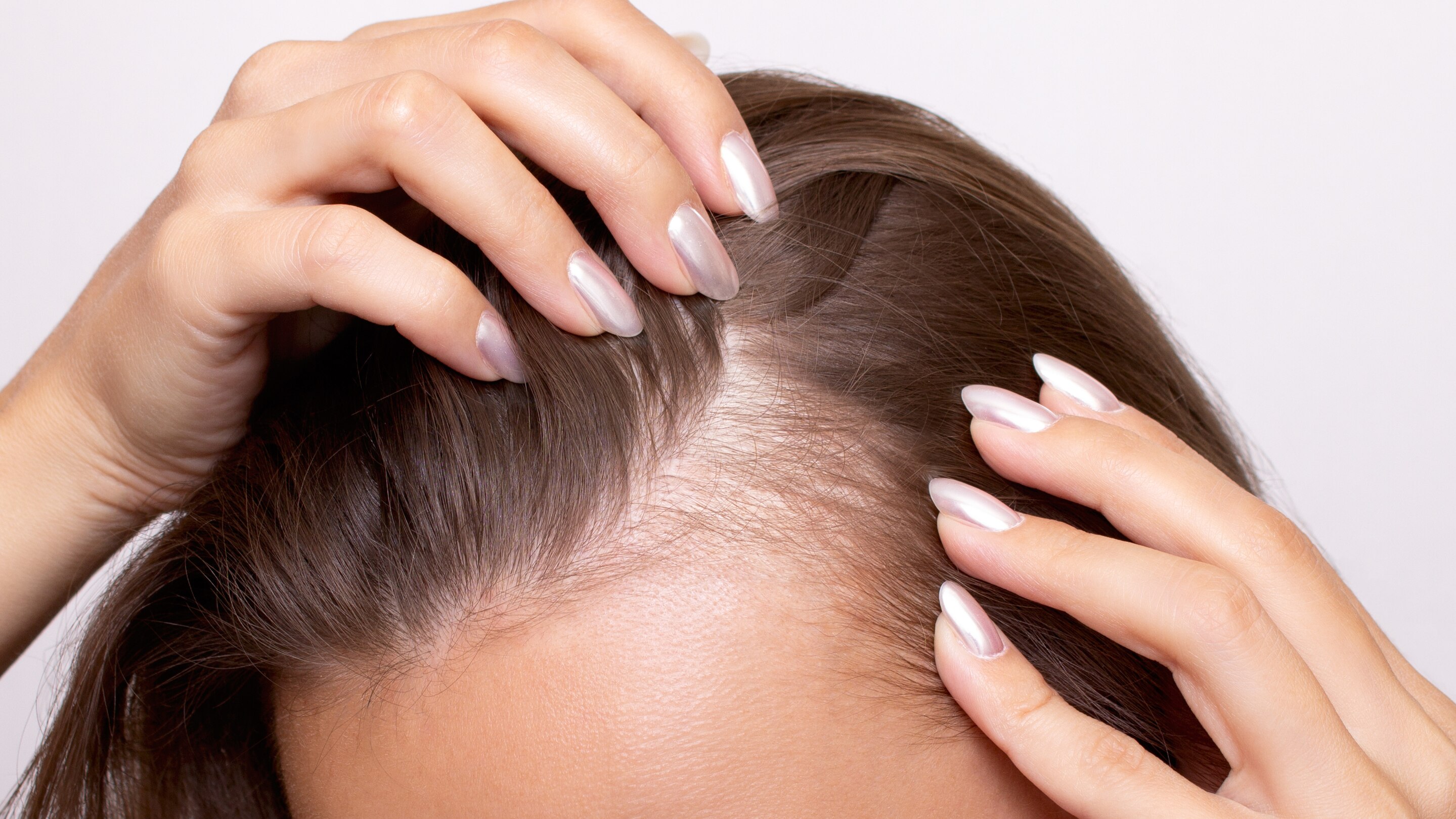 Scalp conditions: