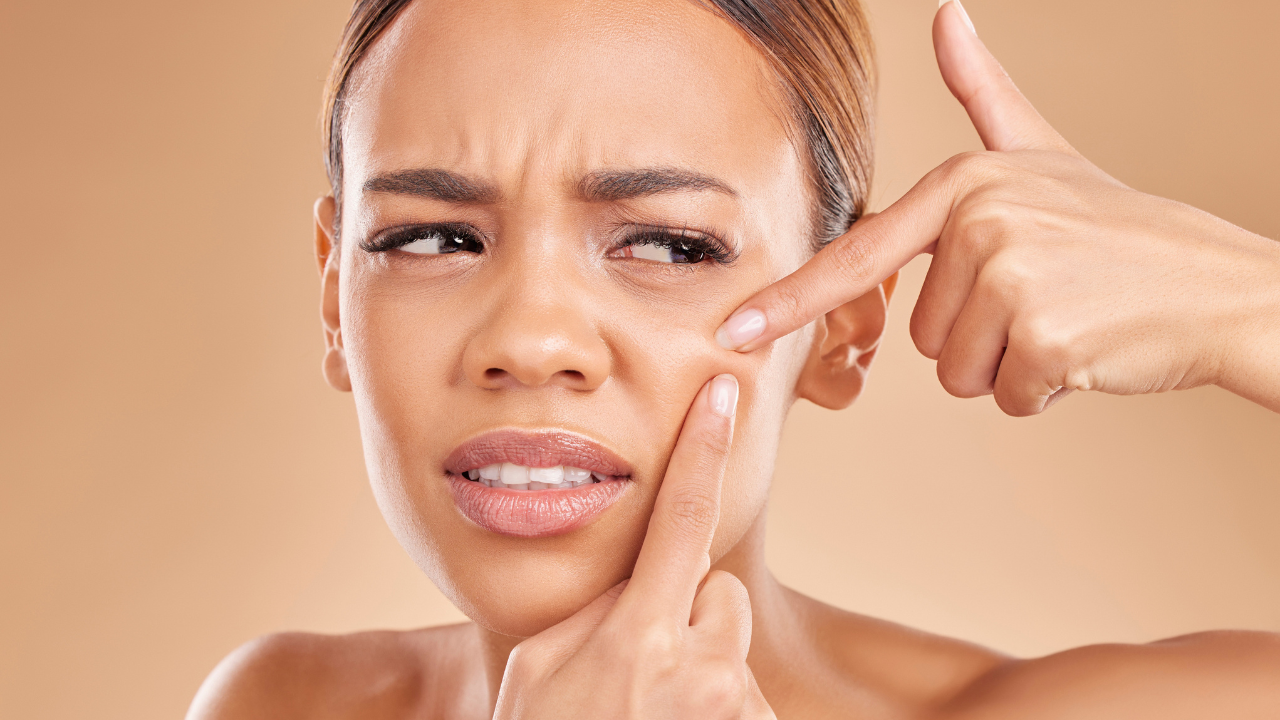 Does Niacinamide Really Help Clear Breakouts?