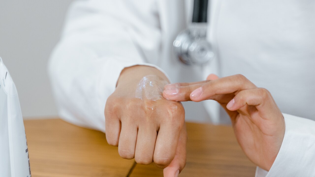Dermat Tips for Acne-Prone Skin