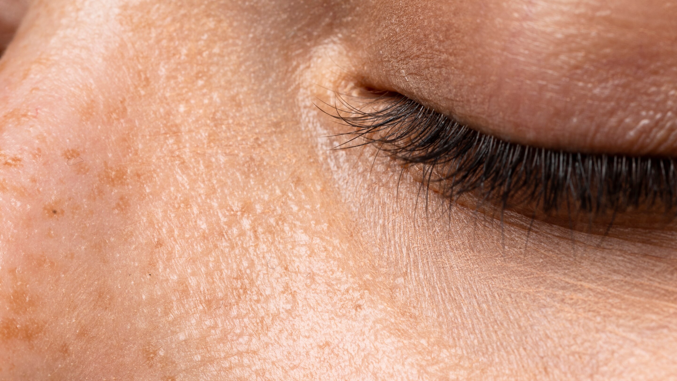 Improves skin texture