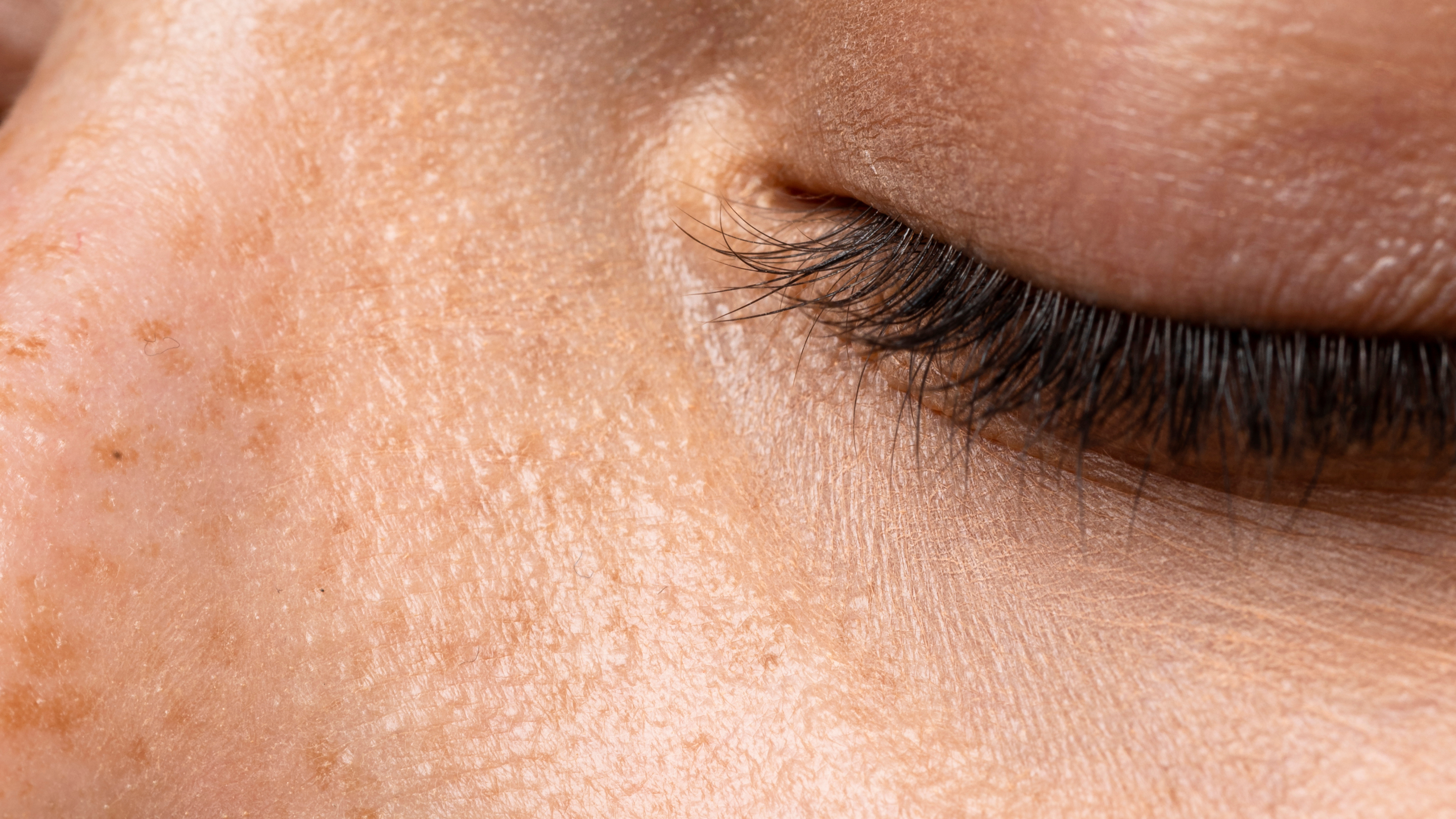 Improves skin texture