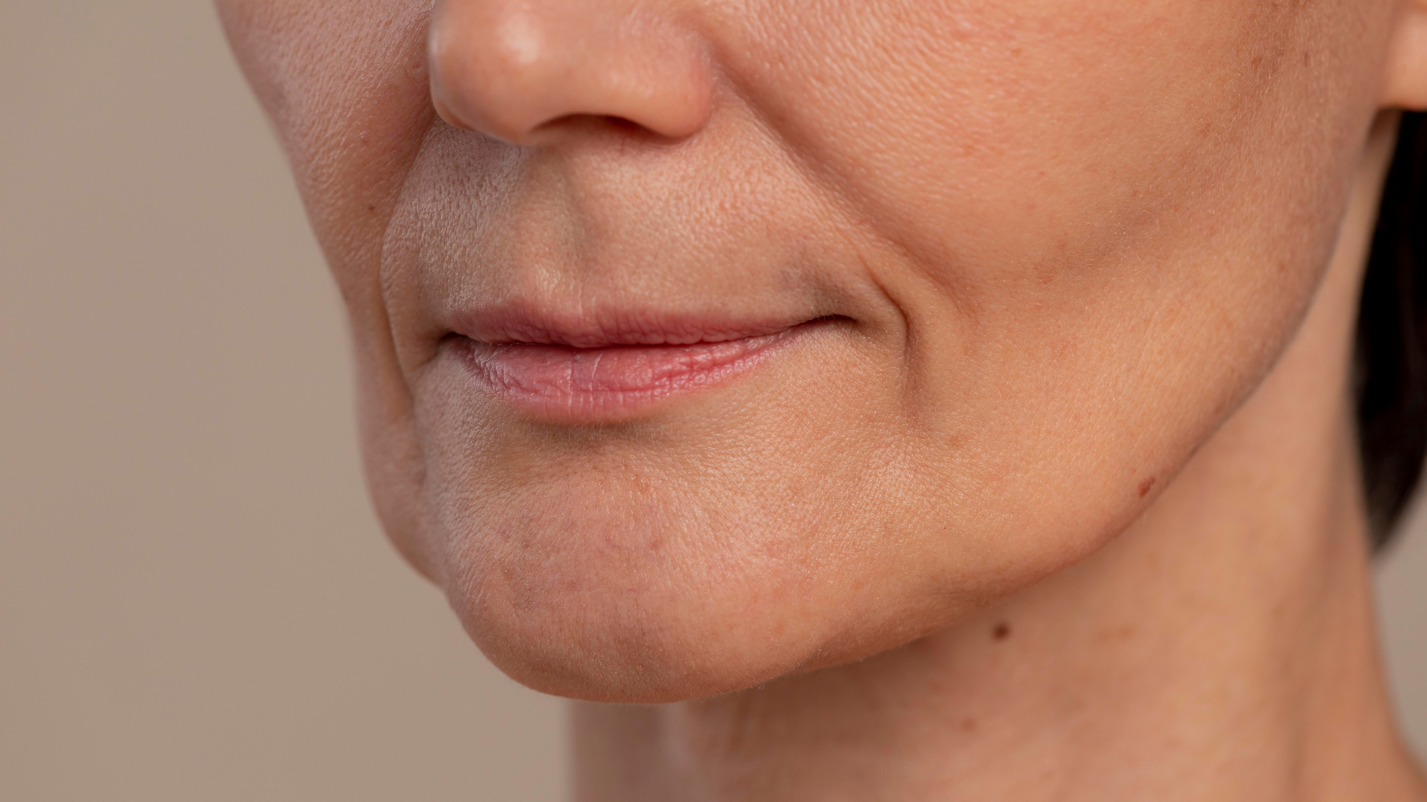Plumps the appearance of fine lines